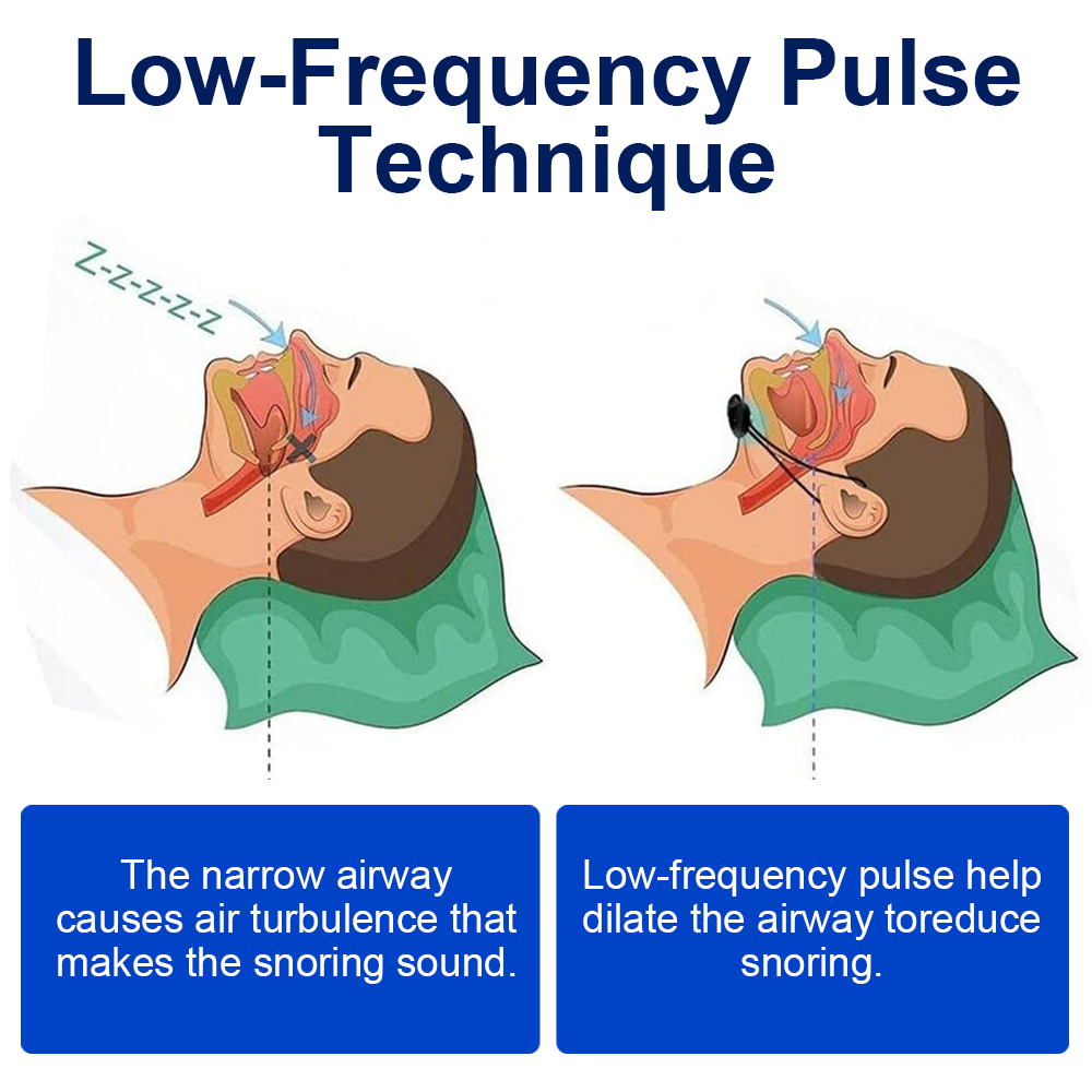 GFOUK™ Vibrating Pulse Snore Stopper