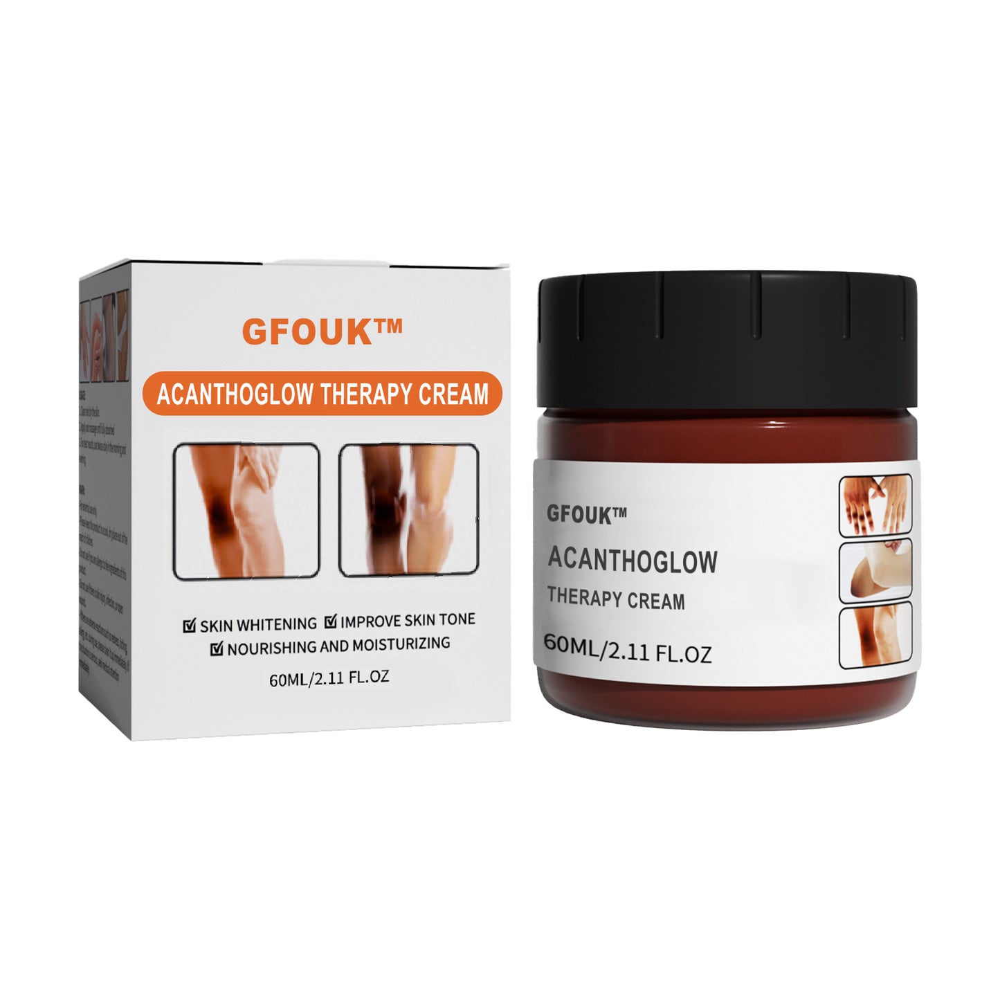 GFOUK™ AcanthoGlow Therapy Cream