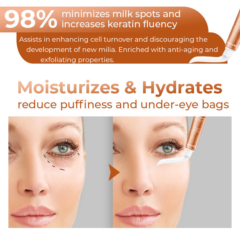 GFOUK™ Milk Spots Removal Eye Cream