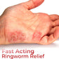 GFOUK™ Hand Ringworm Relief Spray